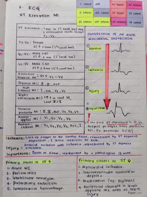 St Elevation Ekg, Ekg Study Guide, Cardiothoracic Surgery Notes, Hematology Notes, Anesthesia School, Emt Study, St Elevation, Medical Terminology Study, Ekg Interpretation