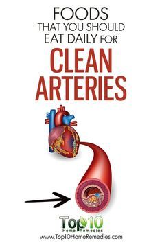 Clean Arteries, Top 10 Home Remedies, Clogged Arteries, Health And Fitness Magazine, Healthy Diet Tips, Ginger Recipes, Daily Health Tips, Bad Food, Fitness Advice