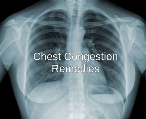 10 Home Remedies for Chest Congestion - Chest congestion is usually associated with some respiratory infection. we discuss some home remedy Chest Cold Remedies, Respiratory Infection Remedies, Home Remedies For Congestion, Natural Expectorant, Remedies For Chest Congestion, Chest Congestion Remedies, Congestion Remedies, Home Remedies For Bronchitis, Chest Cold