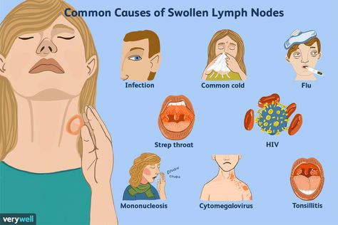 Home Remedies For Bronchitis, Lymph Node, Dental Infection, Lymph Glands, Foot Reflexology Massage, Throat Infection, Strep Throat, Chicken Dip, Healing Touch