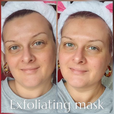 Before and after results from Youology Exfoliating Mask Exfoliating Mask, Hoop Earrings, Mask