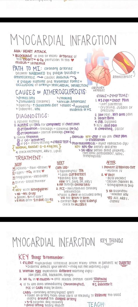 Myocardial Infarct Notes, Paramedic Flashcards, Cardiac Meds, Emt Notes, Lvn School, Cardiology Notes, Charting For Nurses, Nursing School Studying Cheat Sheets, Cardiology Nursing