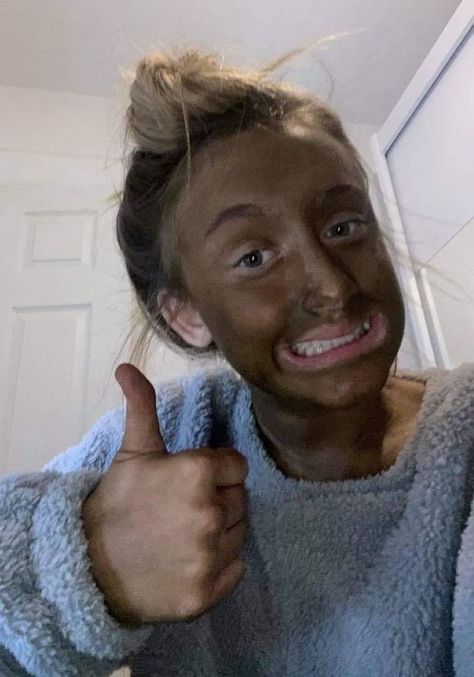 Dark Fake Tan, Self Tan Freckles, Fake Tan Freckles, Fake Tan Aesthetic, Tan Skin Aesthetic, Diy Tanning Lotion, Natural Fake Tan, Best Fake Tan, Tan Fail