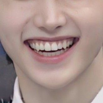 Natural Fangs Aesthetic, Teeth Claim, Natural Vampire Teeth, Sharp Canine Teeth Human, Teeth Side View, Natural Fangs Teeth, Teeth Fangs Natural, Natural Fangs, Fang Teeth