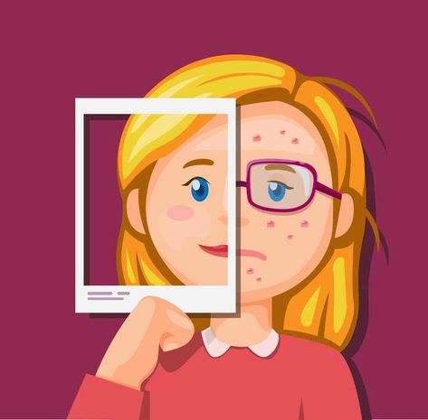 Comparison Illustration, Social Comparison, Social Media Illustration, Social Photo, Vector Girl, Product Illustration, Photo Social Media, Media Illustration, Acne Problem