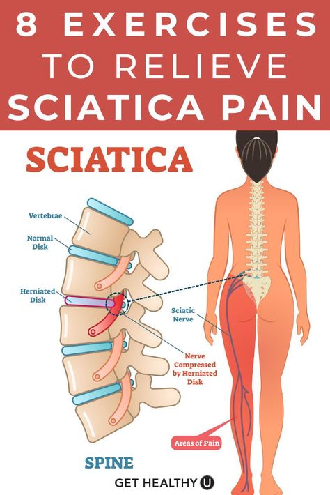 Sciatica is pain, tingling or numbness that comes from the irritation of the sciatic nerve or the nerve roots that lead to the sciatic nerve. The discomfort can be felt in the buttocks on one side, down the side or back of the leg, or even in the ankle and foot. To help keep your sciatic nerve pain at bay, perform these 8 Sciatica stretches a few times a week to help relieve your pain and get you feeling great again. Sciatic Nerve Exercises, Nerve Relief, Sciatic Nerve Relief, Sciatic Nerve Pain Relief, Yoga For Sciatica, Back Pain Stretches, Sciatica Stretches, Sciatica Exercises, Sciatica Pain Relief