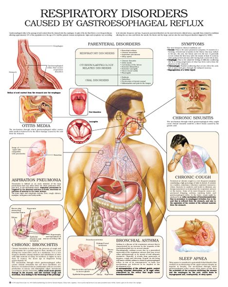 Respiratory Disorders, Respiratory System, Signs And Symptoms, Respiratory, Disease, Physics, Conditioner, Pins