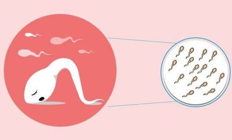 Low Sperm Count: If you are experiencing a Low Sperm Count, you may be wondering what the symptoms, causes, and home remedies are. This article will provide an informative overview… Low Sperm Count, Classy Business Outfits, Sperm Count, Male Fertility, Midsize Style, Hormone Imbalance, Regular Exercise, Home Remedies, Make It Yourself