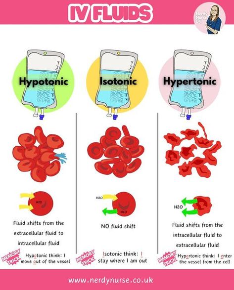 Lauren - Nursing made easy on Instagram: "Understanding IV Fluids: Hypotonic, Isotonic, and Hypertonic Solutions for Student Nurses  1. Isotonic Fluids What They Are: - Isotonic fluids have the same osmolarity as blood plasma (about 275-295 mOsm/L). - They expand the extracellular fluid (ECF) without causing a shift in fluid between compartments.  Common Examples: - 0.9% Sodium Chloride (Normal Saline) - Hartmanns solution - 5% Dextrose in Water (D5W) - initially isotonic, but becomes hypotonic as dextrose is metabolized  Uses: - To treat dehydration - To replace fluid losses (e.g., haemorrhage, surgery) - To maintain fluid balance during surgery  2. Hypotonic IV Fluids What They Are: - Hypotonic fluids have a lower osmolarity than blood plasma (<275 mOsm/L). - They cause water to move int Intracellular And Extracellular Fluid, Fluid Electrolyte Balance Nursing, Fluid Balance Nursing, Fluid Volume Deficit Nursing, Isotonic Hypotonic Hypertonic, Iv Solutions, Extracellular Fluid, Nerdy Nurse, Medical Study