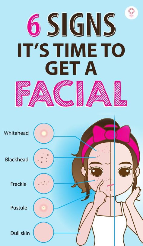 How To Clear Skin, Beauty Self Care, Forehead Acne, Beauty And Skin Care, Facial Tips, Facial Skincare, Natural Face Skin Care, Self Care Ideas, Get Rid Of Blackheads