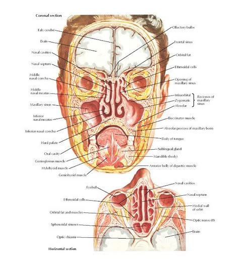 Paranasal Sinuses Anatomy   Coronal section, Horizontal section, Brain, Falx cerebri, Nasal cavities, Nasal septum, Maxillary sinus, Infe... Anatomy Head, Paranasal Sinuses, Maxillary Sinus, Sinus Cavities, Brain Surgeon, Free Drawing, Nasal Cavity, Brain Anatomy, Human Body Anatomy