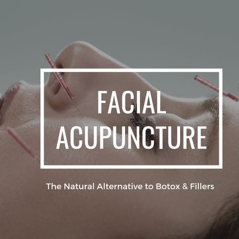 Facial Acupuncture: The Natural Alternative to Botox & Fillers Botox Alternative Products, Facial Acupuncture, Los Angeles Aesthetic, Skin Needling, Botox Alternative, Anti Aging Mask, Botox Fillers, Botox Injections, Yoga Facial