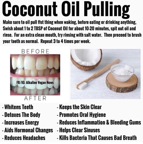 Use coconut oil BEFORE brushing your teeth for these incredible health benefits. Tantric Yoga, Benefits Of Coconut, Holistic Health Remedies, Coconut Oil Pulling, Teeth Health, Benefits Of Coconut Oil, Oil Pulling, Beauty Tricks, Teeth Care