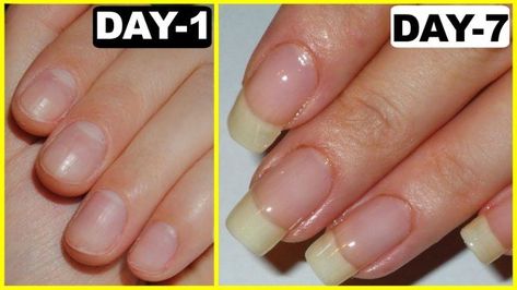 Akordy Na Ukulele, Make Nails Grow, Grow Long Nails, Nail Growth Tips, Grow Nails Faster, Nagel Tips, How To Grow Nails, Brittle Nails, Nail Growth