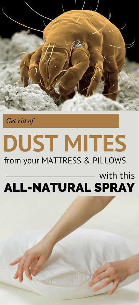 Get Rid of Dust Mites From Your Mattress & Pillows with this All-Natural Spray Dust Allergy Symptoms, Dust Mite Spray, Mattress Spray, Dust Mite Allergy, Mattress Cleaner, Dust Allergy, Insect Spray, Natural Mattress, Mattress Cleaning