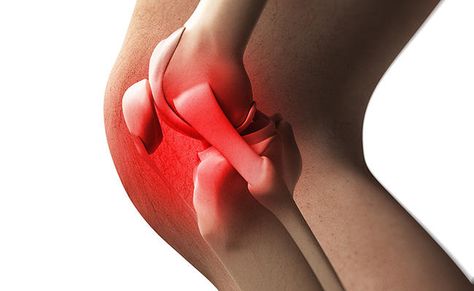 foods that make your joints hurt Knee Ligaments, Joints Pain Remedy, Knee Pain Relief, Joints Pain Relief, Nerve Pain, Knee Pain, Pain Relief, Health