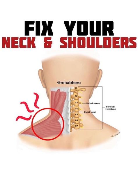 Anatomy Of The Neck, Trapezius Stretch, Neck Pain Exercises, Shoulder Pain Exercises, Upper Back Exercises, Muscles Of The Neck, Mid Back Pain, Low Back Pain Relief, Shoulder Pain Relief