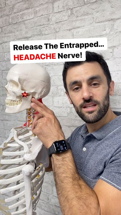 Dr. Joe Damiani - TMJ, Head & Neck Specialist | Do you experience neck pain, headaches, jaw pain, your eyes ache, facial pain, maybe pain at the base your skull? Well, entrapment of the… | Instagram Semispinalis Capitis, Neck Pain Remedies, Neck Sprain, Neck Headache, Neck Pain Exercises, Forward Head Posture Exercises, Neck And Shoulder Muscles, Forward Head Posture, Eye Pain