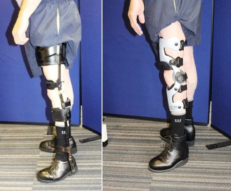 Cumbersome NHS leg calliper vs. lightweight carbon fibre knee brace from Technology in Motion Aesthetic Mobility Aid, Walking Cast, Orthotics And Prosthetics, Braces Girls, Health Goth, Prosthetic Leg, Leg Braces, Body Pose Drawing, Mobility Aids