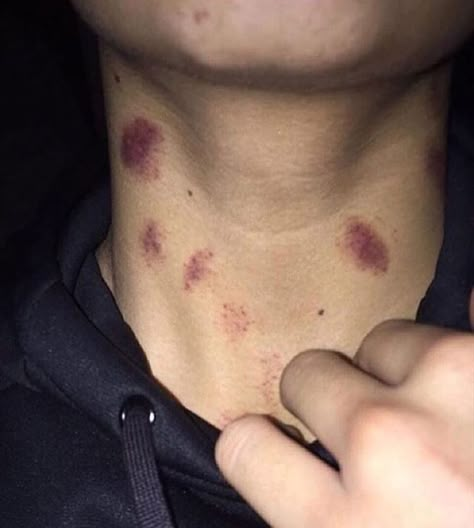 Hickies Neck, Couple Goals Teenagers Pictures, Me N Him, Inappropriate Thoughts, Dream Relationship, Physical Touch, Couple Goals Teenagers, Cute Relationship Photos, My Kind Of Love