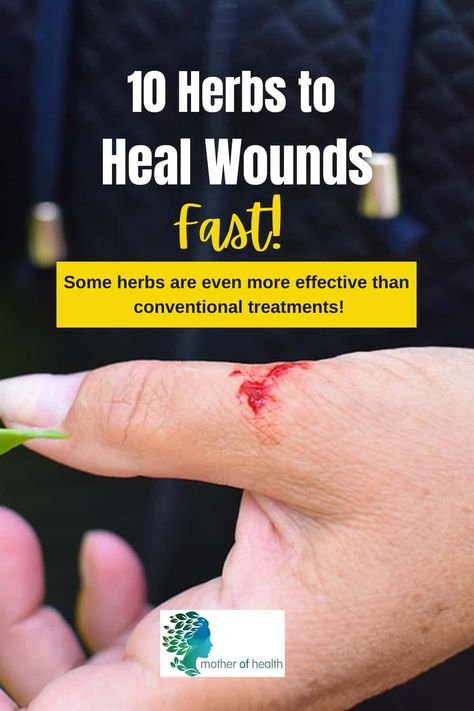 When it comes to healing wounds, nature has provided us with an abundance of herbs that can help. Here are 10 herbs to heal wounds fast and includes tips on how to use them. Herbs For Wound Healing, Heal Cuts Fast, Herbs To Heal, Heal Wounds Faster, Healing Wounds, Holistic Health Remedies, Holistic Health Coach, Holistic Remedies, Homemade Remedies