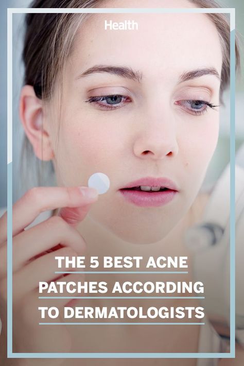 We asked experts to weigh in on what you really need to know about pimple patches. #acne #pimplepatch #health Best Pimple Patch, Getting Rid Of Pimples, Under The Skin Pimples, Hydrocolloid Bandages, Cystic Acne Remedies, Different Types Of Acne, Blind Pimple, Acne Patches, Skincare Shop