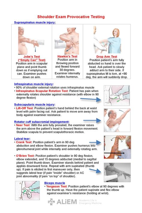 Shoulder Exam - Provocative Testing ... Shoulder Special Tests, Special Tests Physical Therapy, Labral Tear Shoulder, Supraspinatus Muscle, Subscapularis Muscle, Infraspinatus Muscle, Manual Muscle Testing, Biceps Muscle, Physical Therapy School