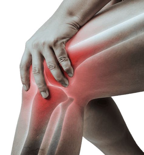 knee pain image Sore Knee, Knee Recovery, Sore Knees, Knee Pain Exercises, Acl Tear, Knee Surgery, Knee Pain Relief, Knee Replacement, Ayurvedic Medicine