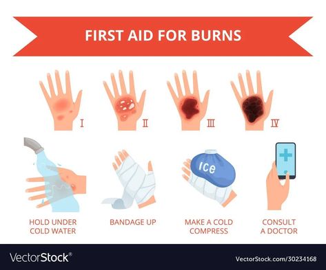 Skin Infographic, First Aid Poster, First Aid For Burns, First Aid Tips, Fire Vector, Nursing School Survival, Skin Burns, Vector Infographic, Human Hand