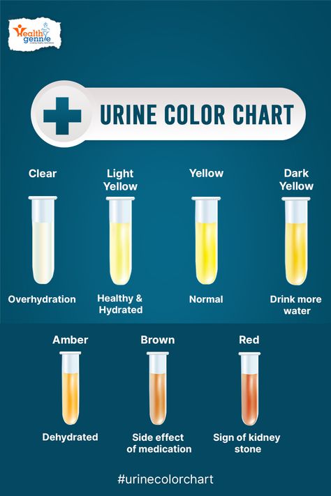 Physical Examination Of Urine, Urine Color Chart, Color Of Urine, Nutrition Bulletin Boards, Urine Color, Nursing Notes, Workout For Women, Health Check, Fitness Workout For Women