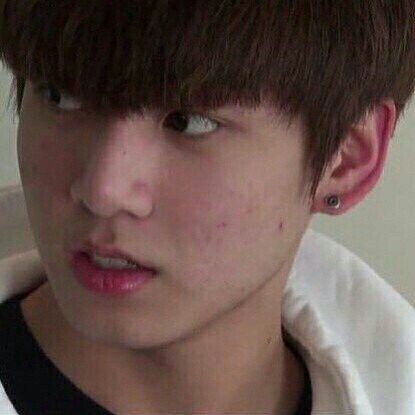 Jungkook Acne, Jungkook No Makeup, Jungkook Without Makeup, Bts Bon Voyage, Jeongguk Jeon, Jungkook Oppa, Bare Face, Face Acne, Without Makeup