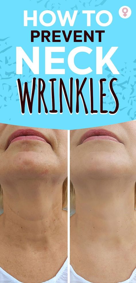 How To Prevent Neck Wrinkles: Regardless of their age, no one likes the sight of wrinkles on their neck and face. Neck wrinkles are fine lines that appear along the front and back of your neck. They can eventually become furrows or deep crevices if not treated on time. These wrinkles are challenging to hide and may even hurt your aesthetics and self-image.