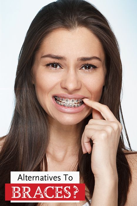 Most #adults don't want to look like the goofy kid in junior high with a mouth full of #braces…  The good news? There are better options than previous generations ever had. Learn how more adults are getting a perfect #smile WITHOUT the #metal mouth! How To Look Good With Braces, Adult Braces, Kids Braces, Perfect Smile, The Good News, Junior High, Braces, Good News, The Good