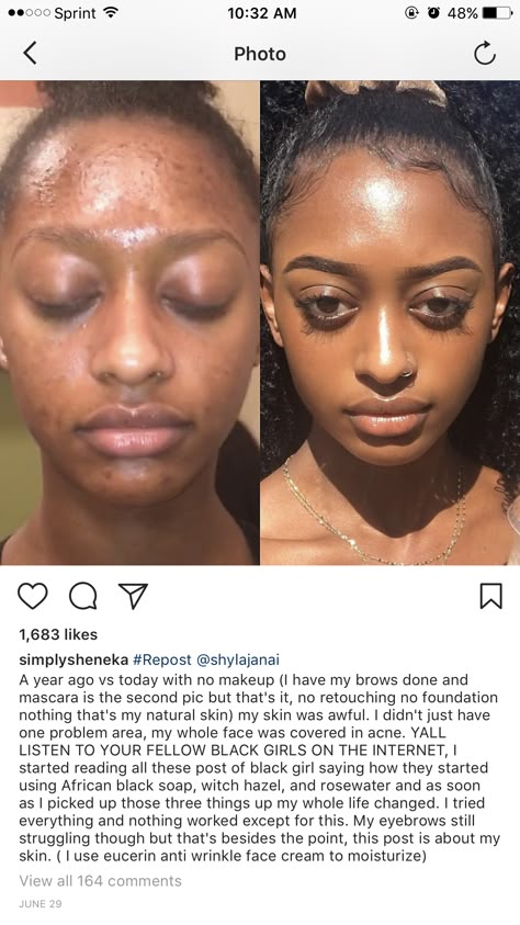 Clear Skin Overnight, Vaseline Beauty Tips, Haut Routine, Black Skin Care, Skin Goals, Clear Skin Tips, Glo Up, Skin Routine, Girl Tips