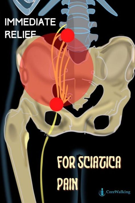 Siatic Nerve, Sciatic Nerve Relief, Hip Flexor Exercises, Piriformis Muscle, Sciatica Pain Relief, Sciatica Relief, Lower Back Pain Exercises, Sciatic Nerve Pain, Sciatica Pain