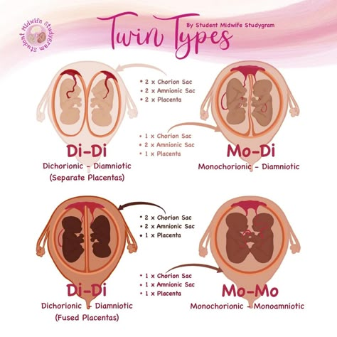 Nicu Nurse Education, Types Of Twins, Ultrasound School, Nursing School Inspiration, Nurse Teaching, Midwifery Student, Diagnostic Medical Sonography, Student Midwife, Nursing School Motivation