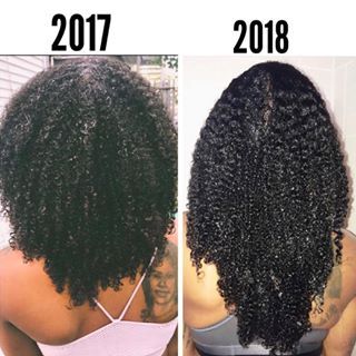 One year difference. Hair Growth Progress, Natural Hair Growth Remedies, Natural Hair Growth Tips, Hair Growth Secrets, Natural African American Hairstyles, Hair Concerns, Hair Remedies For Growth, Hair Growth Faster, Natural Hair Inspiration