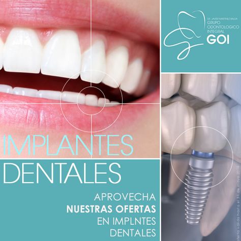 Dental Banner, Dentist Social Media, Dermatologist Skin Care, Dental Posters, Dental Marketing, General Dentistry, White Teeth, Dental Implants, Dental Clinic