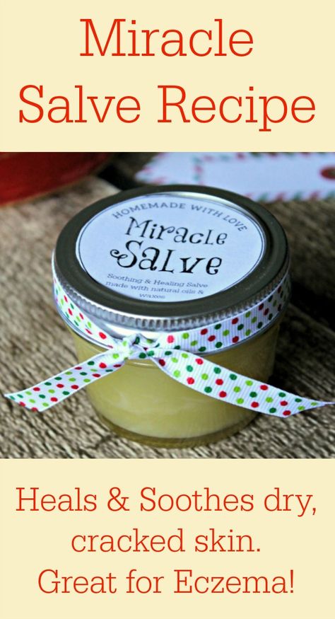 Miracle Salve Recipe with Free Printable Labels - Great for eczema, too! #salve #homemade #diy Homemade Salve, Salve Recipes, Diy Lotion, Scaly Skin, Homemade Lotion, Labels Printables Free, Homemade Bath Products, Homemade Remedies, Diy Body