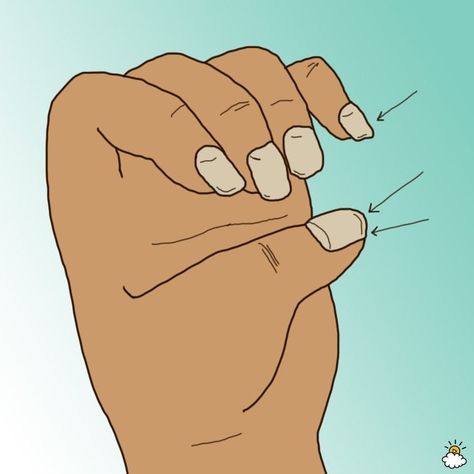 thickened nails Weird Shapes, Red Flags, Red Flag, Us Nails, Overall Health, Health Issues, Pay Attention, Makeup Tips, You Nailed It