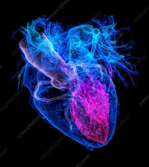 Human Heart Illustration, A Human Heart, Computed Tomography, Anatomical Heart Tattoo, Human Body Facts, Heart 3d, Ct Scan, Medical Imaging, Heart Illustration