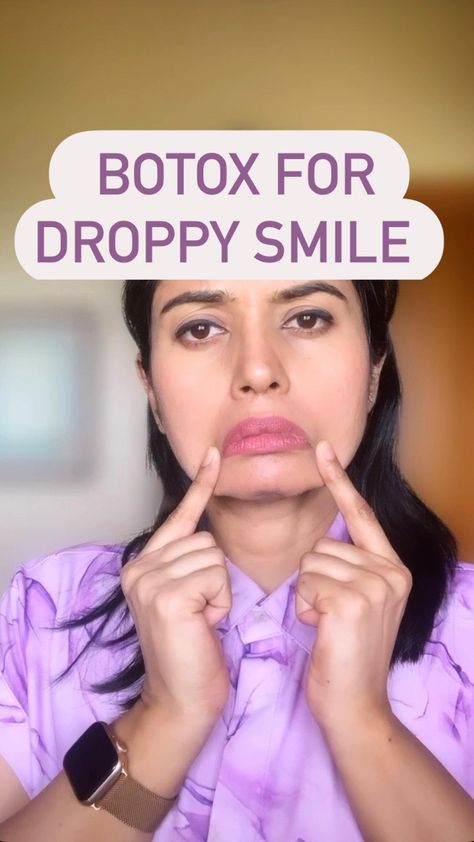 People say I look so happy ❤️and I say that’s the BOTOX ❤️ Botox can improve your quality is life ,not just your wrinkles ❤️ People refer… | Instagram Botox In Smile Lines, Corners Of Mouth Turned Down, Person Pulling Mouth Reference, Botox To Lift Corners Of Mouth, Botox For Frown Lines, Botox Marionette Lines, Botox For Downturned Mouth, Botox For Smile Lines, Smile Lift Botox Before And After