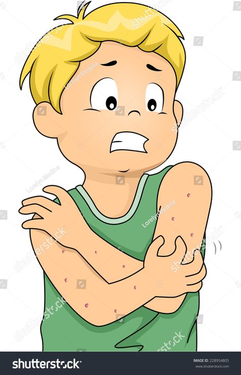 Illustration Featuring a Boy Itching All Over Due to an Allergic Reaction #Ad , #Ad, #Boy#Featuring#Illustration#Itching Reaction Drawing, Allergic Reaction, Free Vector Graphics, A Boy, Reaction Pictures, Vector Graphics, Allergies, Drawing Illustrations, Vector Illustration