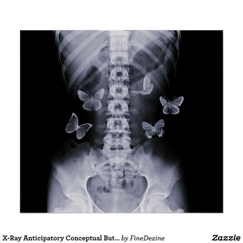 Butterflies Poster, Xray Art, Butterfly Poster, Picture Collage Wall, Picture Collage, Butterfly Wallpaper, Custom Posters, X Ray, Aesthetic Backgrounds