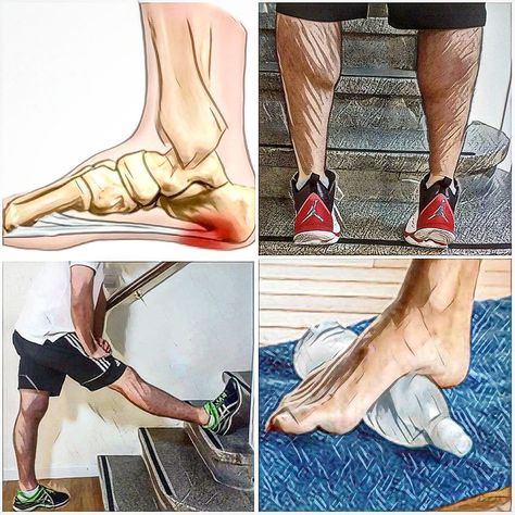 Tratamiento fascitis plantar Facitis Plantar, Diy Door, Reiki, Pie, Yoga, Health