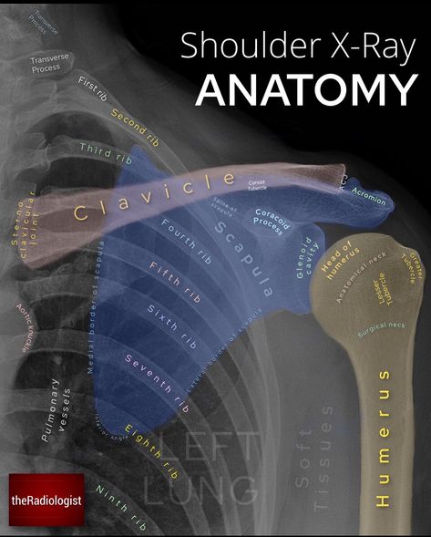 X Rays Human, Radiology Positioning, Radiology Student Study, Radiology Notes, Radiography Student, Rad Tech Student, Radiology Schools, Medical Radiography, Shoulder Anatomy