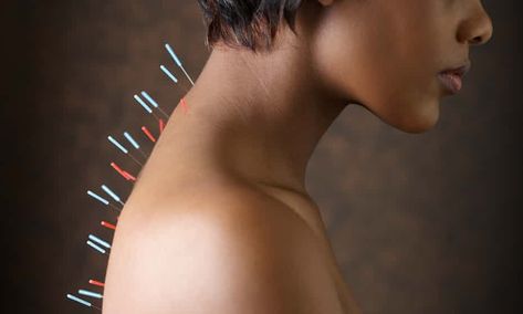 Pains and needles: brain scans point to hidden effects of acupuncture Juicing Recipes For Beginners, Acupuncture Benefits, Acupuncture Needles, Migraine Pain, Lower Inflammation, Brain Scan, Alternative Healing, Human Brain, Back Pain Relief