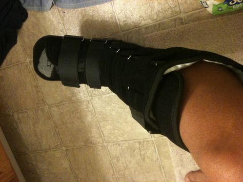 Sprained Ankle Aesthetic, Broken Hand Cast, Ankle Strapping Injury, Fractured Ankle, Fractured Ankle Recovery, Broken Ankle Cast, Ankle Cast, Ankle Surgery, Broken Ankle