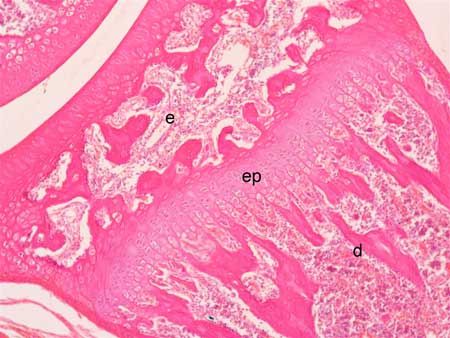 Epiphyseal Plate, Hyaline Cartilage, Human Anatomy And Physiology, Anatomy And Physiology, Human Anatomy