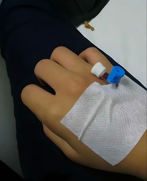 Hand Niddle Hospital, Canular On Hand, Fake Drip On Hand Snap, Saline Hand Hospital Real Pic, Illness Snap, Hand Drip Pics, Dextrose In Hand Hospital, Dextrose In Hand Hospital Girl, Canular On Hand Snap